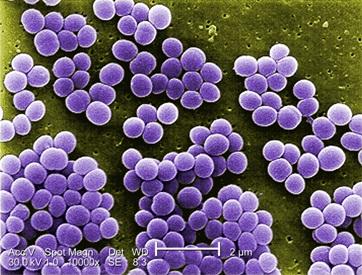 staphylococcus1330729784945